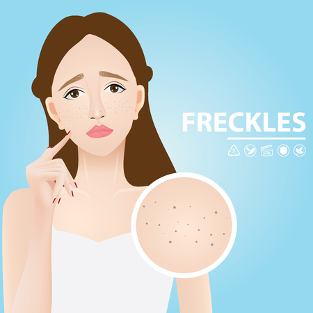 Freckles skin vector illustrationのイラスト素材