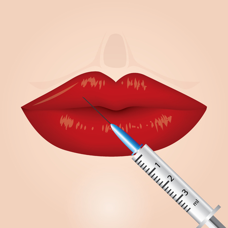 lip surgery before and after vector illustrationのイラスト素材