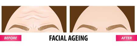Facial aging before and after vector illustrationのイラスト素材