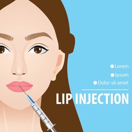 Lip injection before and after vector illustrationのイラスト素材