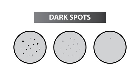 Spots skin to clear steps vector illustrationのイラスト素材