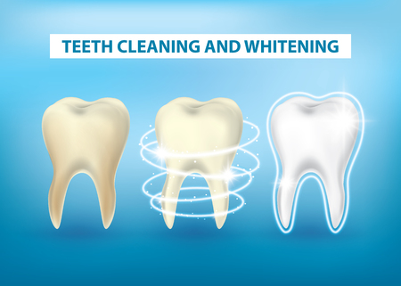 Dental cleaning and whitening vector illustrationのイラスト素材