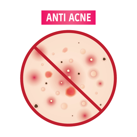 Anti acne vector illustrationのイラスト素材