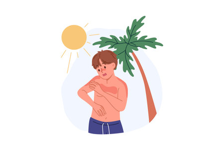 Boy received sunburn due to ultraviolet allergy or heliophobia, standing on beach with palm tree. Lack of sunscreen caused sunburn in child requiring medical attention or medicinal ointmentのイラスト素材