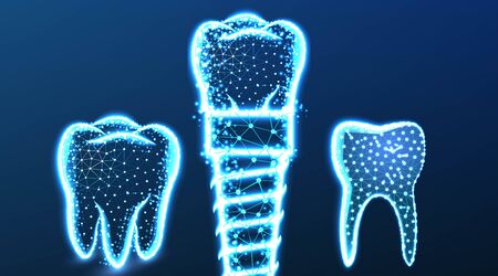 Tooth, dental implant. Abstract Low Poly wireframe Mesh Design. Vector Illustration