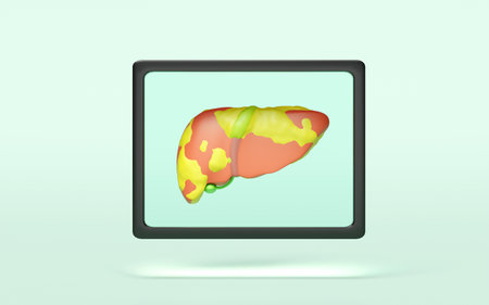 3d x ray film liver isolated on green background. check liver health, fatty liver disease, world...