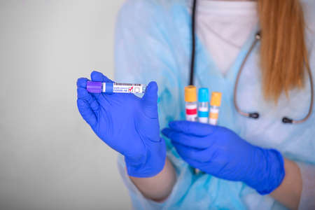 a girl, a medical worker, examines a test tube with a positive test result for covid-19の写真素材
