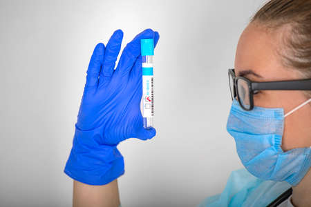 a girl, a medical worker, examines a test tube with a positive test result for covid-19