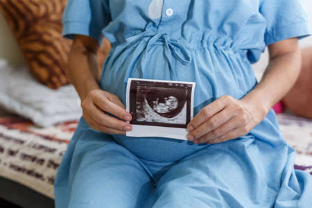 Pregnant woman holds ultrasound photo on the belly.の写真素材
