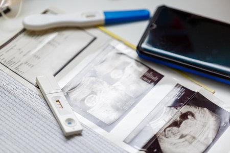 positive pregancy test with ultrasound photo.の写真素材