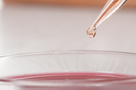 blood in petri dishes, blood testの写真素材