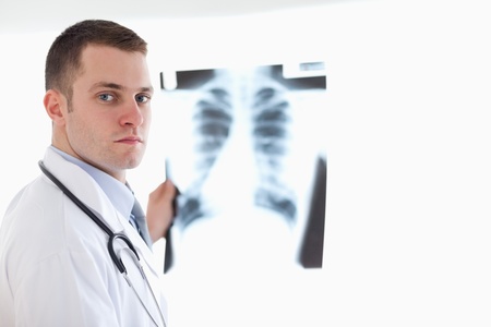 Serious looking doctor holding x-ray image against light