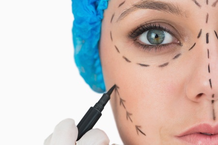 Plastic surgeon marking face on white backgroundの写真素材