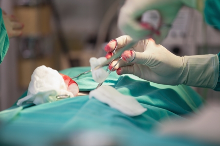 Surgeon using a surgical scissor in operation theatreの写真素材