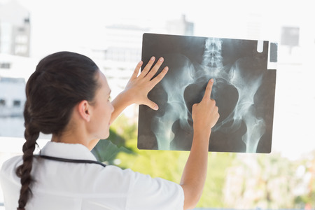 Rear view of a female doctor examining x-ray in the medical office