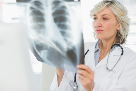 Serious female doctor examining x-ray in the medical officeの写真素材