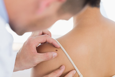 Male doctor examining mole on back of woman in clinicの写真素材