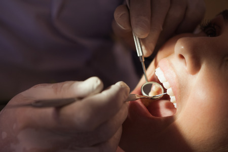 Dentist examining a patients teeth in the dentists chair under bright light at the dental clinicの写真素材