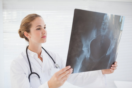 Focused doctor looking at xray in her office