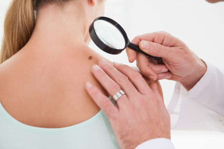 Doctor examining a brown spot on a patients shoulderの写真素材