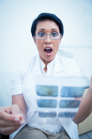 Shocked female dentist looking at x-rayの写真素材