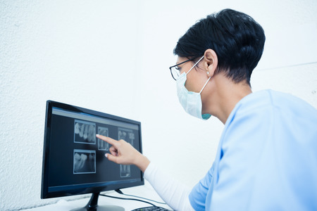 Concentrated female dentist looking at x-ray on computerの写真素材
