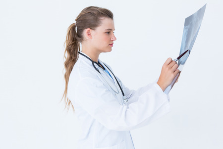 Focus doctor looking at X-Rays on white backgroundの写真素材