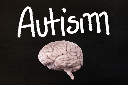 brain against blackの写真素材