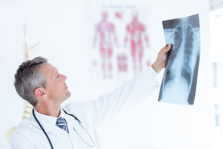 Thoughtful doctor holding xray in medical office