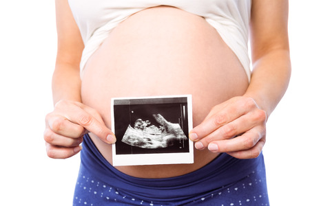 Pregnant woman showing ultrasound scans on white background