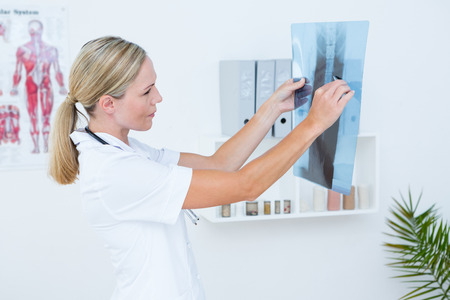 Concentrate doctor looking at X-Rays in medical officeの写真素材