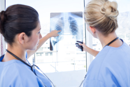 Doctors looking at Xray  in medical officeの写真素材