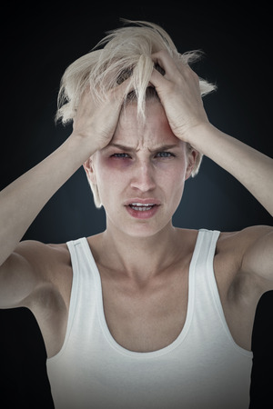 Sad blonde woman with head pain holding her head  against blue background with vignetteの写真素材