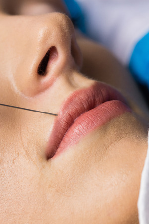 Woman receiving Botulinum toxininjection on her lips in a examination roomの写真素材