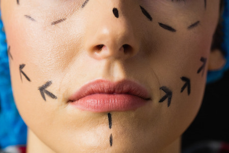 Peaceful young patient with dotted lines on the face in an examination roomの写真素材