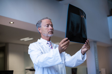 Male surgeon examining x-ray at hospitalの写真素材