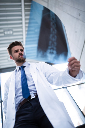 Doctor examining X-ray report in hospitalの写真素材