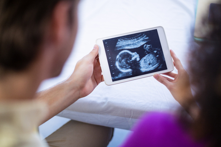Couple looking at babies ultrasound scan on digital tablet in hospitalの写真素材