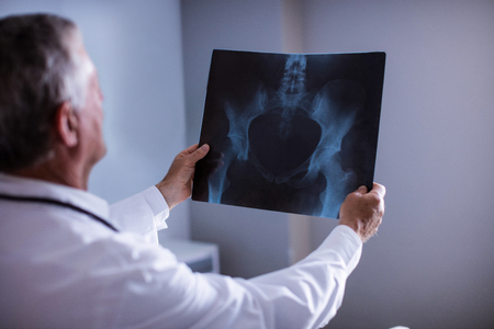 Male doctor examining x-ray report at hospital