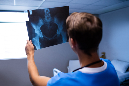 Male doctor examining x-ray report at hospitalの写真素材