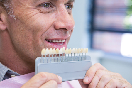 Close up of man holding medical equipment at dental clinic