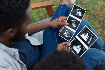 Overhead of couple looking at sonography in parkの写真素材