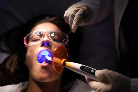 High angle view of a dentist examining a Caucasian patient with dental curing light in clinic while the patient is opening her mouth and wearing safety glassesの写真素材