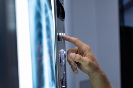 Close-up of Caucasian surgeon operating light box in operation theater at hospitalの写真素材