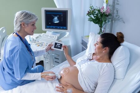 High angle view of Caucasian female doctor doing ultrasound scan for pregnant woman in the hospitalの写真素材