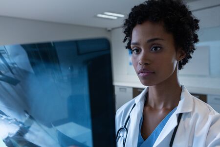 Close-up of African-american female doctor examining x-ray in the hospital. Shot in real medical hospital with doctors nurses and surgeons in authentic settingの写真素材