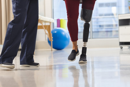Midsection of caucasian physiotherapist and senior woman with artificial leg walking. Hospital, disability, physiotherapy, work, medicine and healthcare.の写真素材