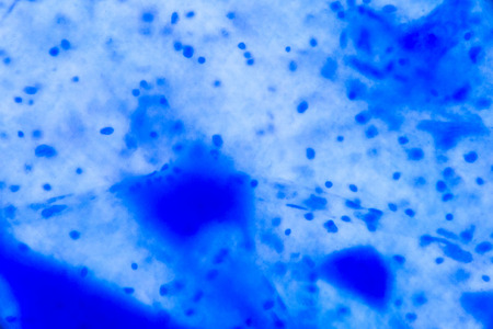 Nerve cell under the microscope - Abstract blue dots on white background.