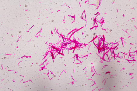 Smooth muscle separate under the microscope - Abstract pink lines on white background.の写真素材