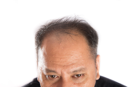 close up of Asian man glabrous hair lessの写真素材